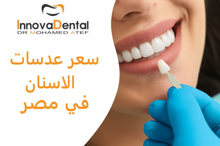 Dental veneers price in Egypt
